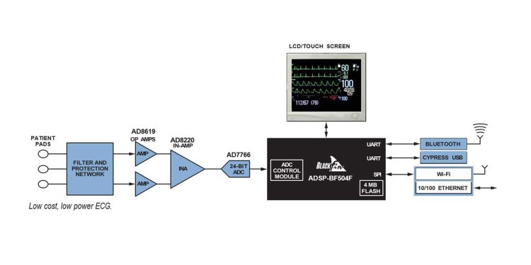 ECG